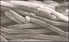 Bacillus Antracis